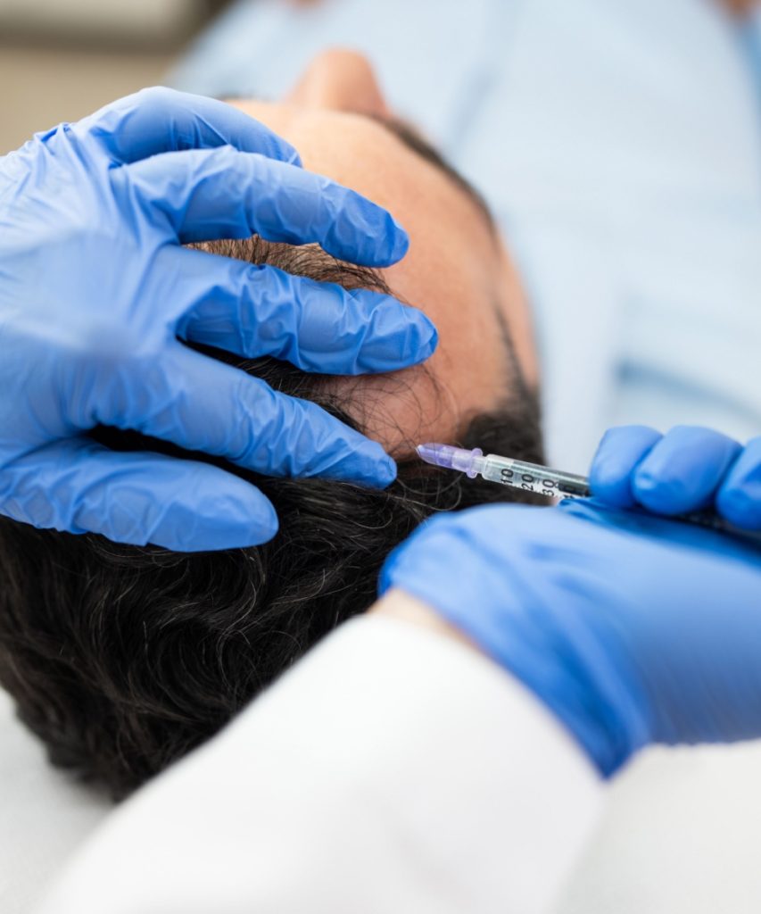 Hair Restoration Treatment for Men at The Mere Aesthetics & Wellbeing Clinic